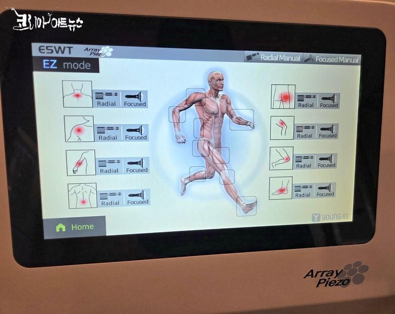 [KAN :메디컬수첩] 비급여치료, 체외충격파 치료...궁금하면 클릭하세요